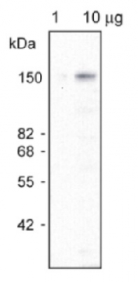MRP1, ABCC1 | ABC transporter C family member 1 in the group Antibodies for Plant/Algal / Membrane Transport System / Vacuolar membrane at Agrisera AB (Antibodies for research) (AS09 472)
